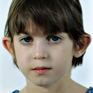 Child patient before ear surgery