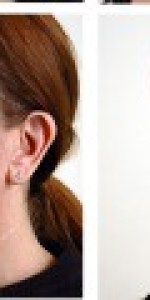 Multiple views of patients before and after facelift surgery